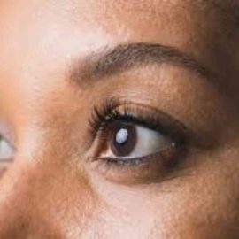 Choosing the right eye allergy medications in Nigeria involves considering factors such as effectiveness, safety, affordability, and availability