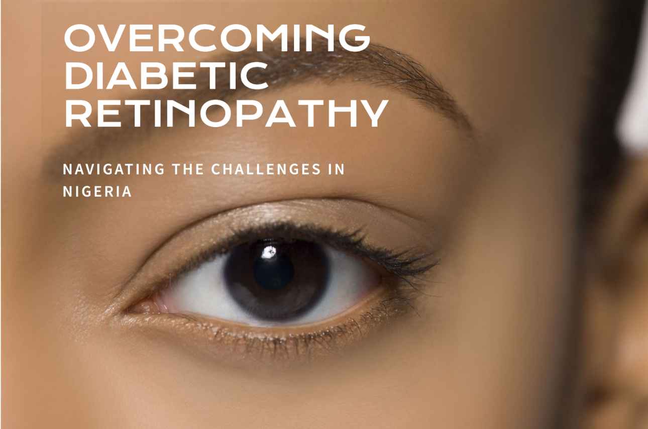 By monitoring the health of your eyes through regular eye exams, you can ensure that any signs of diabetic retinopathy are addressed promptly. This proactive approach can help in preserving your vision and overall eye health.