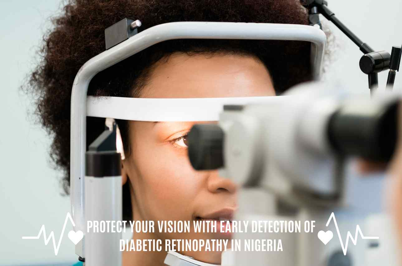 Protect your vision with early detection of diabetic retinopathy in Nigeria